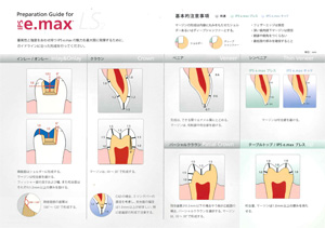 e-Max｜歯科技工 有限会社クレバーハンズ インプラント・オール